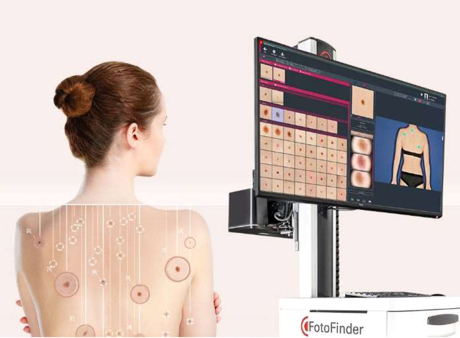 Dr. Guilherme Gadens | Dermatologista e oncologia cutânea. Cirurgia de Mohs. Mapeamento Corporal. Foto Finder. Mapeamento de pintas