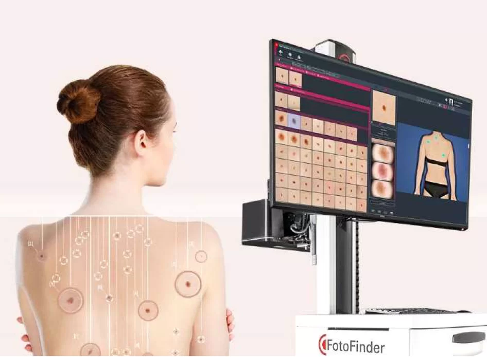 Dr. Guilherme Gadens | Dermatologista e oncologia cutânea. Cirurgia de Mohs. Mapeamento Corporal. Foto Finder. Mapeamento de pintas