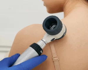 Prevenção, diagnóstico e tratamento de câncer de pele em Curitiba com o Dr. Guilherme Gadens.