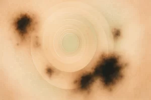 Imagem abstrata centralizada com formas circulares translúcidas, texturas orgânicas e padrões celulares difusos em tons de pele, verde-claro e dourado, representando vigilância e regeneração cutânea com áreas escuras dissipando-se em luz suave